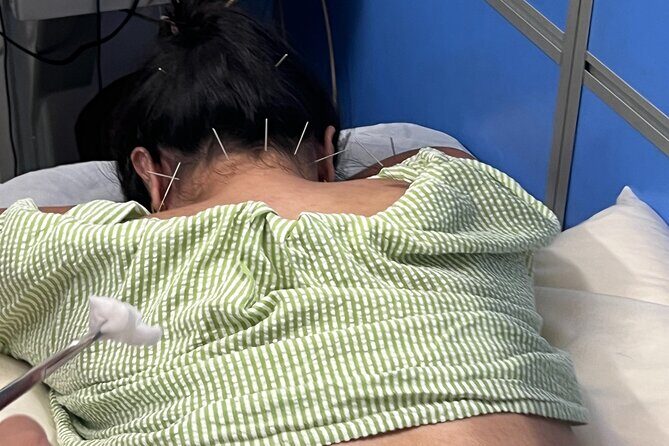 Acupuncture and Suction Cups Session at the Hospital - Who Would Love This Tour?