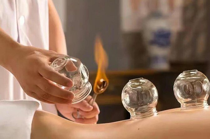 Acupuncture and Suction Cups Session at the Hospital - FAQs