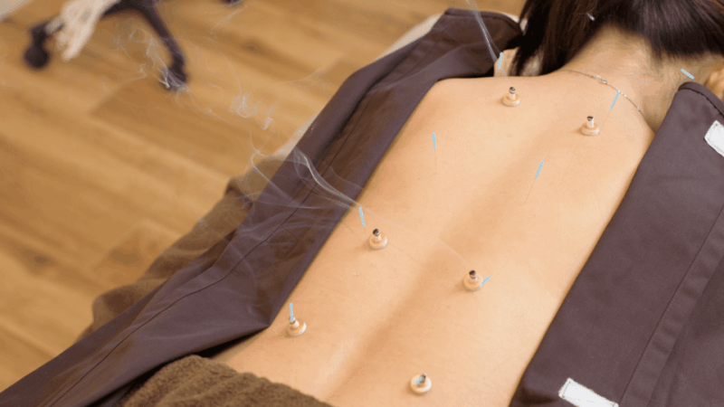 hiroshima-acupuncture-and-japanese-unique-massage-treatment
