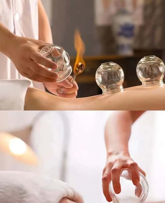 Shanghai: Chinese Medicine Acupuncture and Cupping Session - Shanghai: Chinese Medicine Acupuncture and Cupping Session – A Deep Dive into Ancient Healing