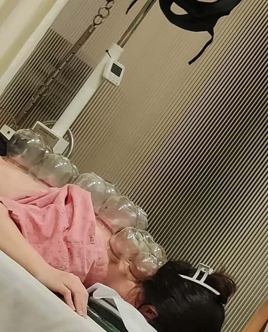 Shanghai: Chinese Medicine Acupuncture and Cupping Session - Key Points