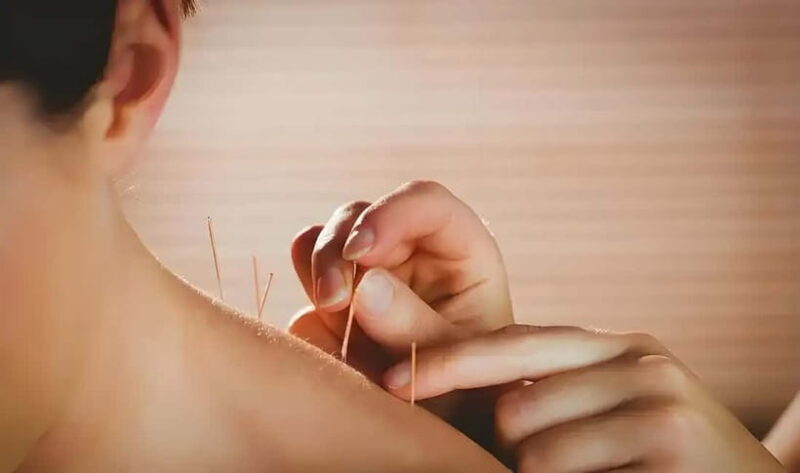 Shenzhen: Acupuncture Experience with TCM Practitioner - The Sum Up